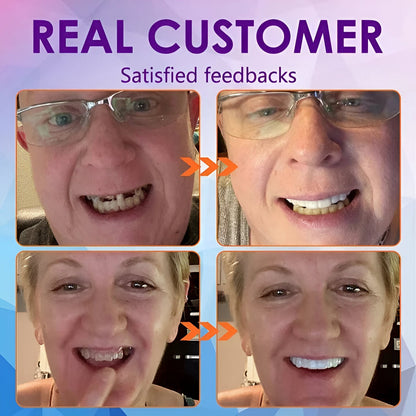 SmileSure™ - Denture Set