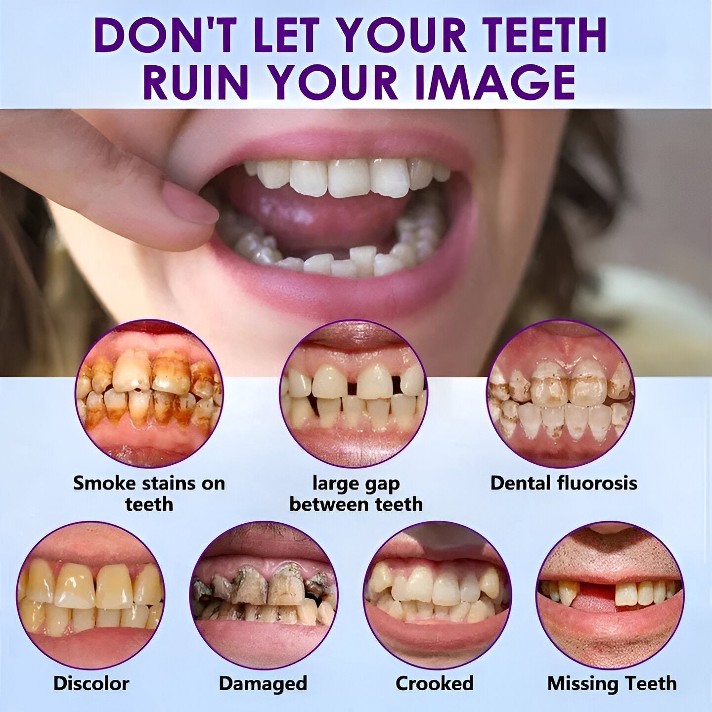 SmileSure™ - Denture Set